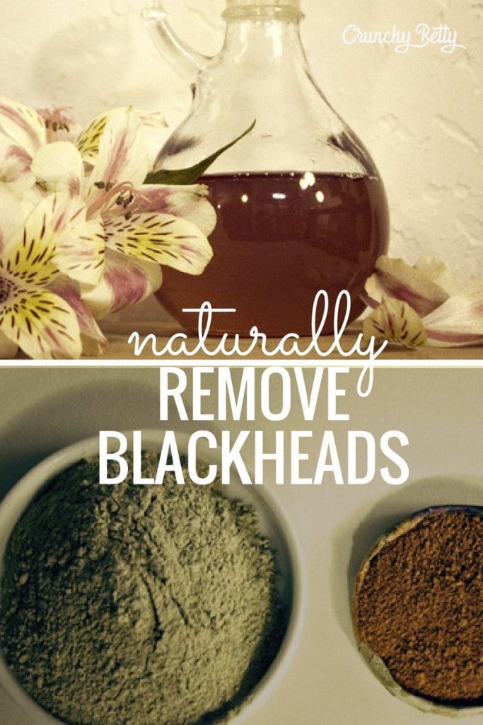 5 Natural Ways to Remove Blackheads 5